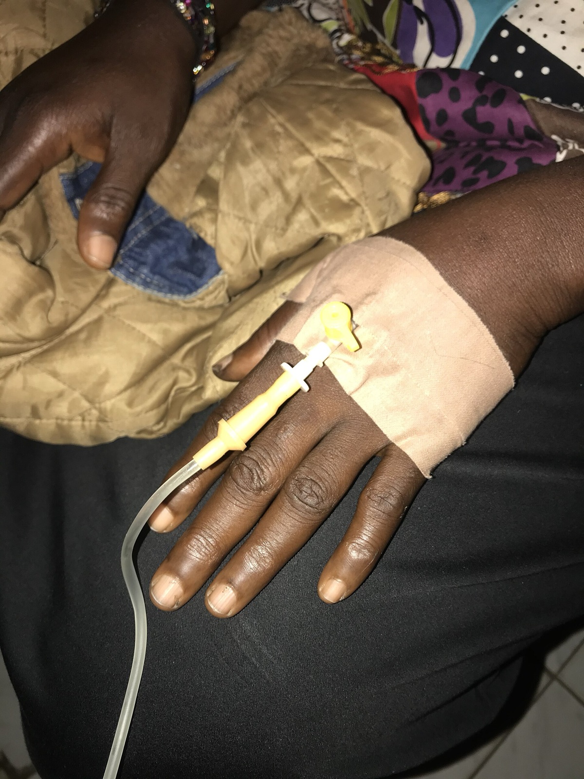 A hand with an IV line taped in place